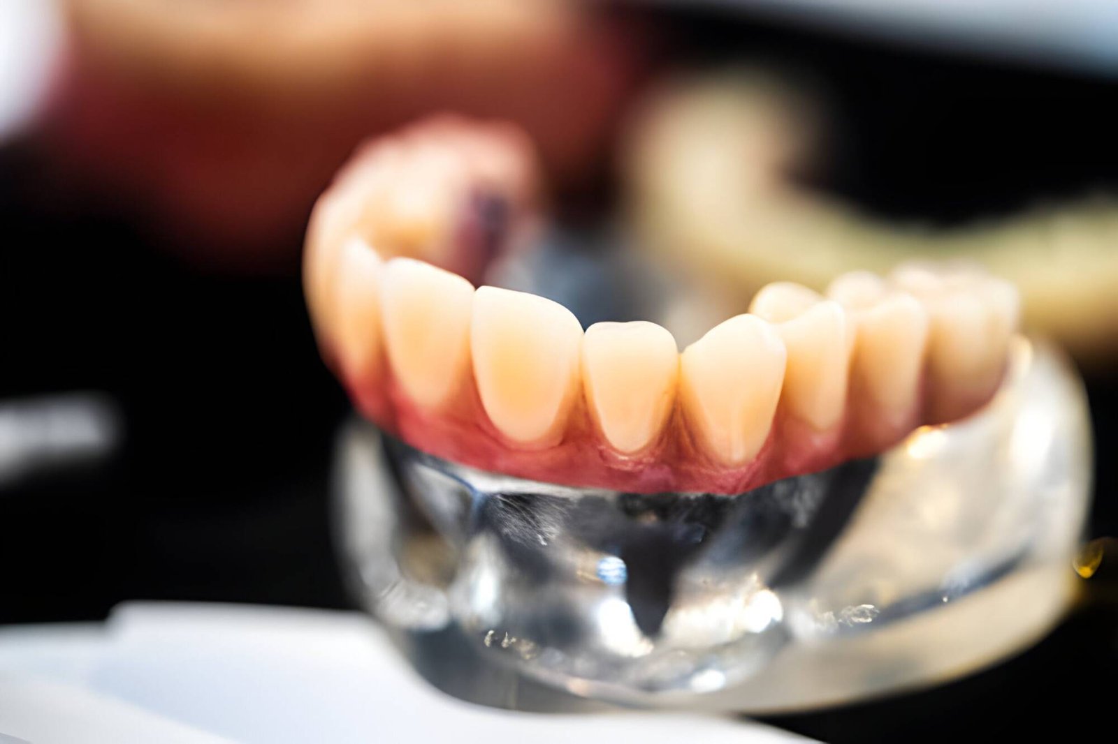 Can You Lose Your Gums Around Dental Implants?