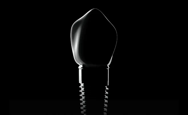 Dental implant silhouette on black background
